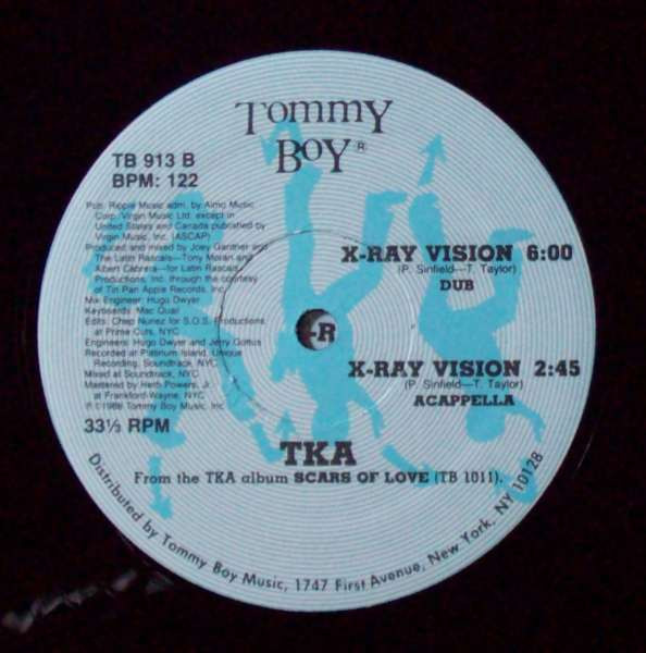 TKA - X-Ray Vision | Tommy Boy (TB 913) - 4